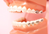 歯科矯正の写真