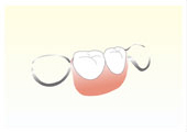 義歯の写真