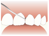 歯科検診の写真